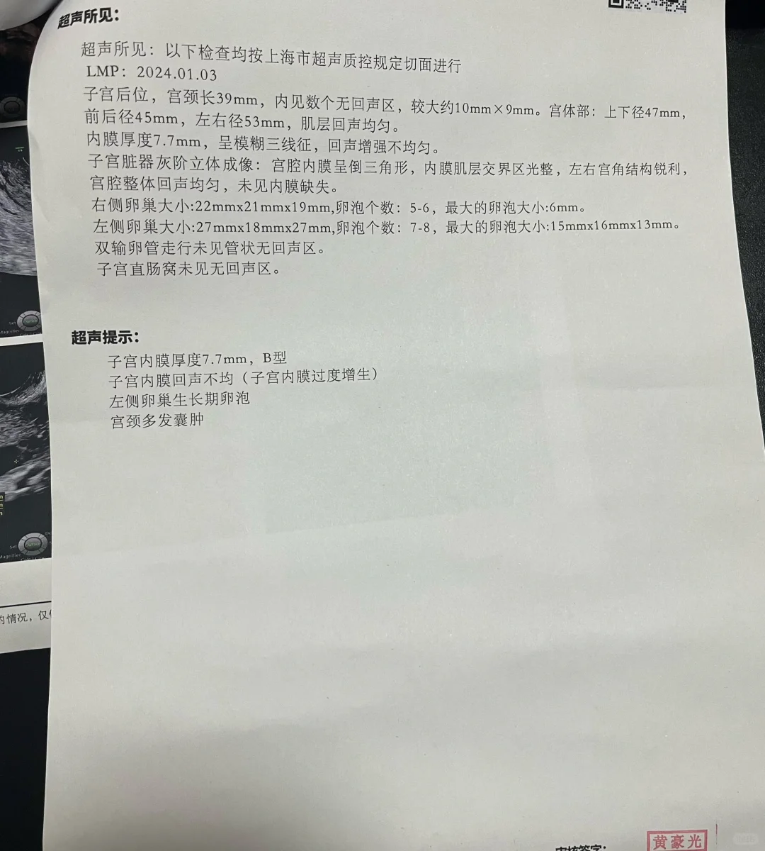 试🧪日常 | 三维B超 | day15