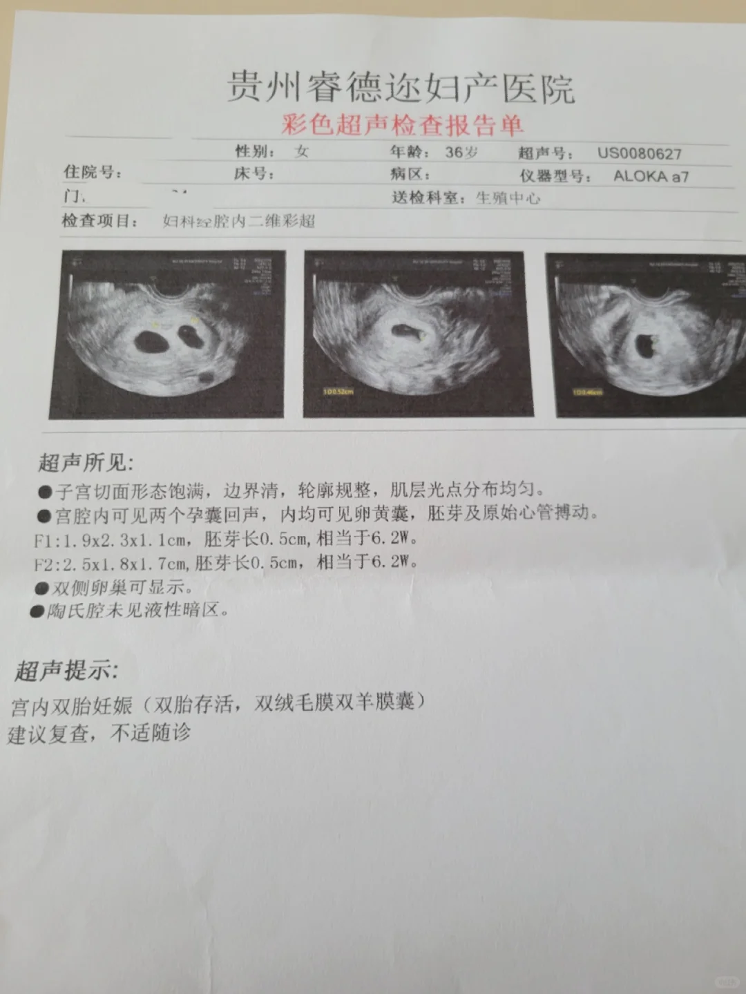 开奖了，移植后四周的第一次B超,三代试管代孕选性别_人工供卵代怀咨询服务