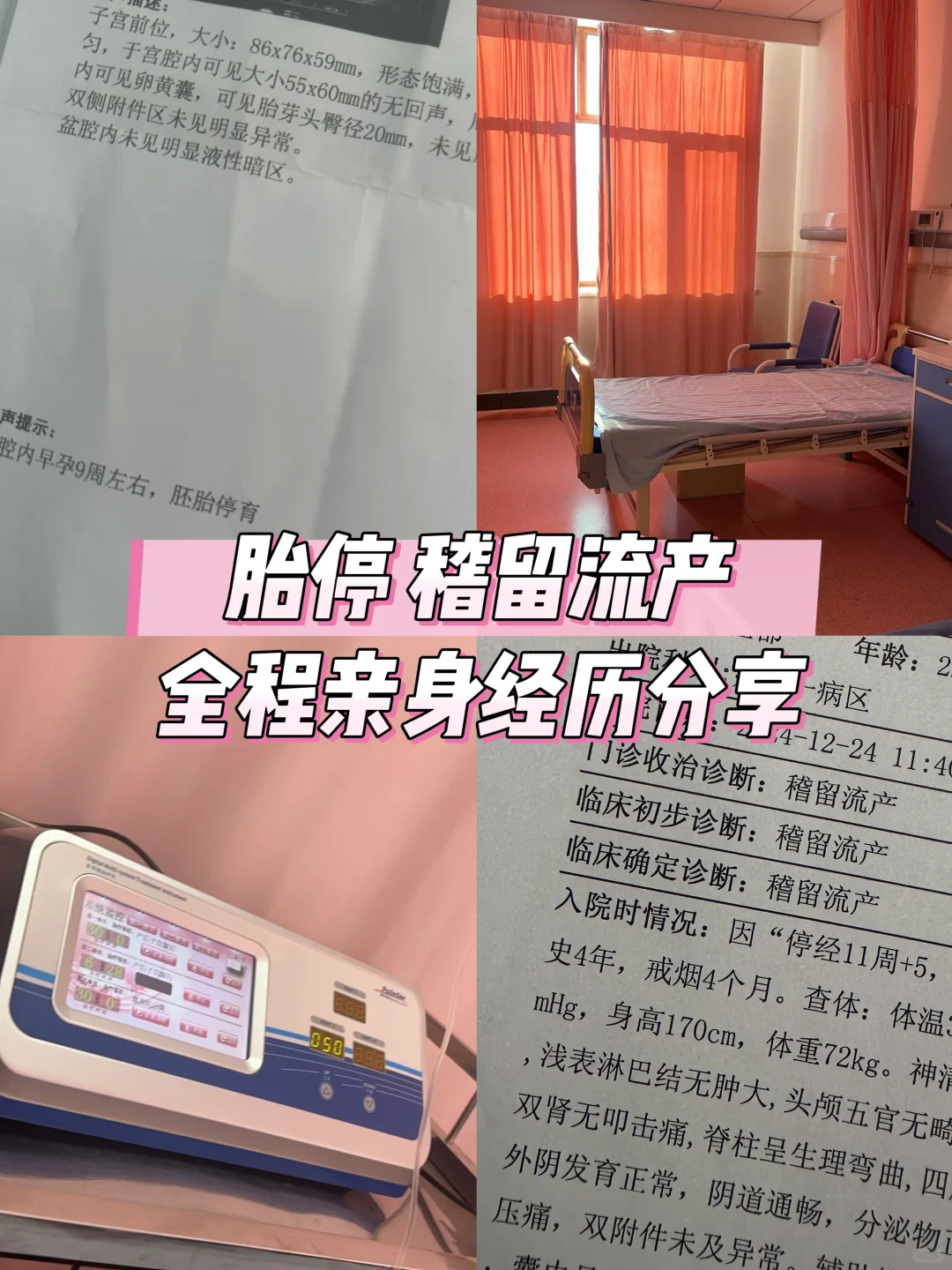 胎停…稽留流产顺利无清宫！